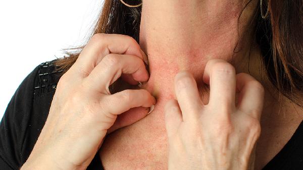 身上的黑痣可能会变成“恶性肿瘤”？医生：有这3个特征的要警惕