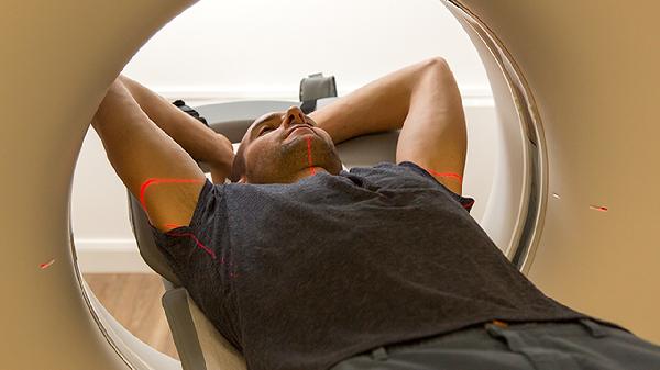 警惕！CT次数做多了，未来10年这种癌风险高43%！4类人尤其要注意