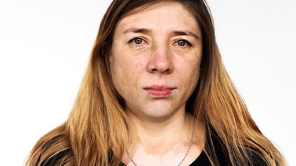 女人进入更年期后身体总是疼痛?忠告:日常吃点这类食物或可缓解