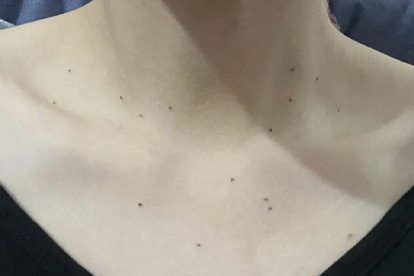 男性感染HPV以后,身体会陆续出现这3个症状,医生:早期需警惕!