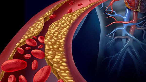 气温越来越高，高血脂老人要警惕这些习惯，别拿健康闹着玩