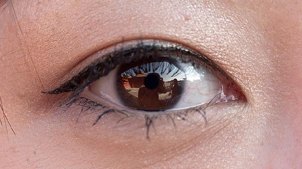 女性沙眼衣原体是性疾病吗