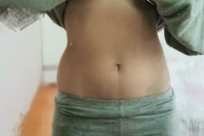 减腰部和肚子赘肉最佳方法