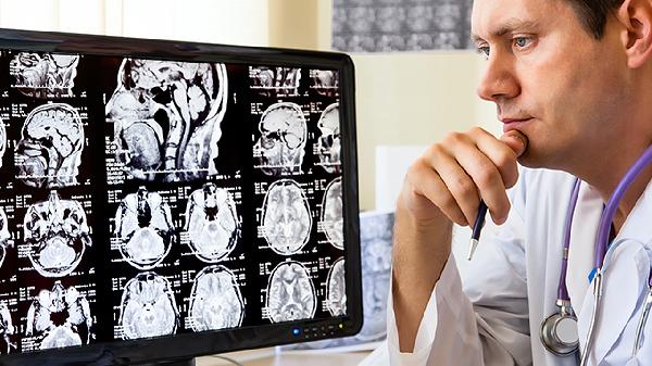 乏力的常见原因及鉴别诊断 乏力见于哪些疾病