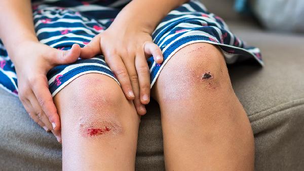 大腿根部长了个软肉粒