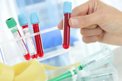 弓形虫检测需要空腹抽血吗