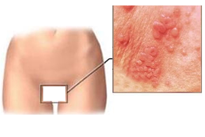 婚检能查出什么慢性病