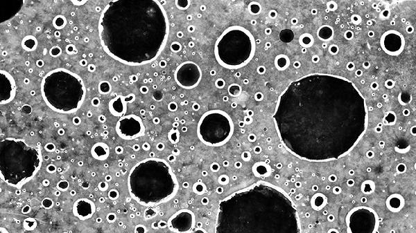 嗜酸细胞百分比0.1严重吗