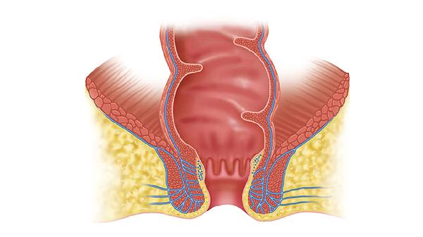 练臀部的器械名称叫什么