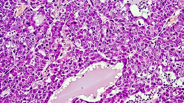 微生物报告是检测什么