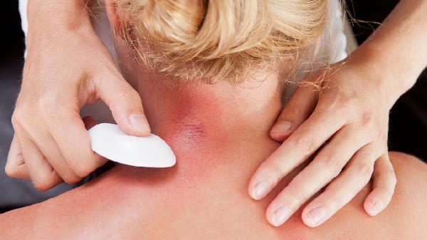 刮痧后喝酒了有什么后果吗