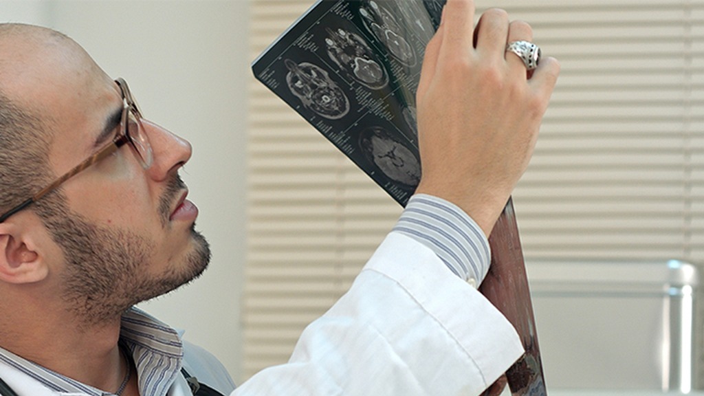 腔隙性脑梗塞不一定是病？仍然可以跑步，但要注意几个细节