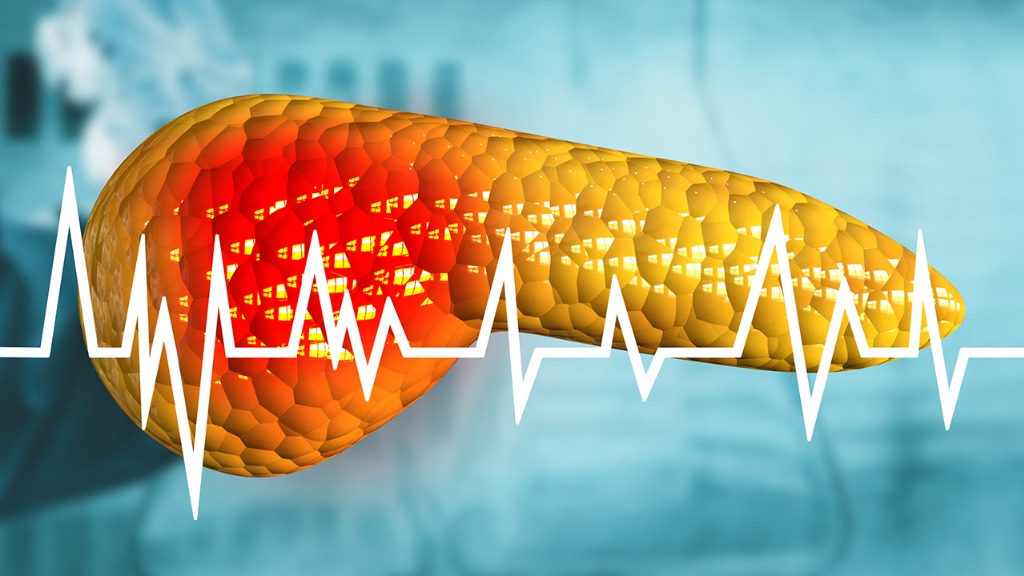 医生分析多位胰腺癌患者，发现：患胰腺癌的人，多有3习惯