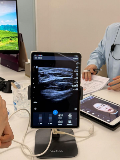 2025 年B超引导下馒化修复机构大揭晓