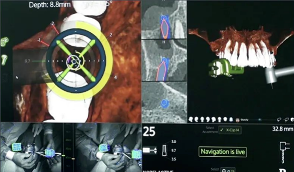 数智鼎植 | 宁波鼎植口腔医院盛大开业，科技赋能口腔诊疗新维度