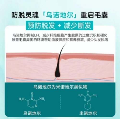 2025防脱洗发水排行榜:十大热门品牌深度解析,第一名效果太硬核