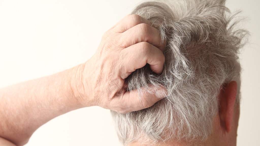 头上白头发多？建议平时多吃这3类食物，黑芝麻未上榜