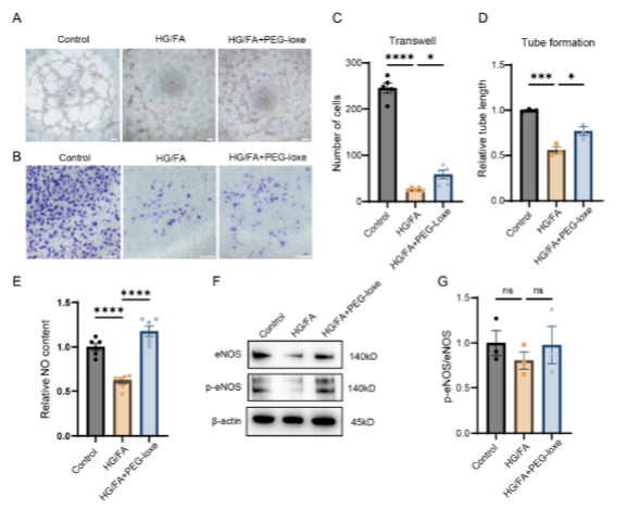 世界卒中日│翰森制药GLP-1RA 周制剂洛塞那肽可降低糖尿病患者卒中风险