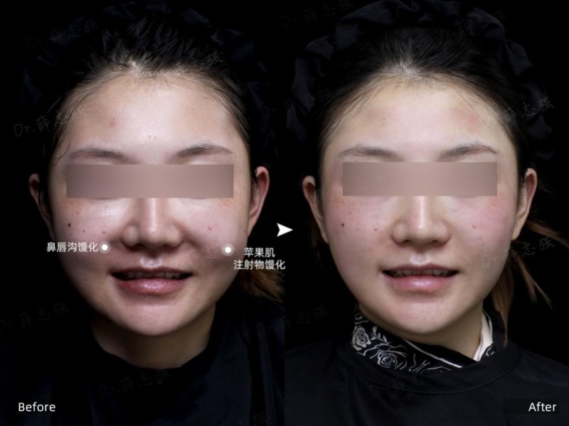 哪家医美做馒化修复好？2025年11月馒化修复机构推荐