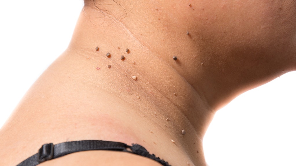 身体出现这4种异样，可能是癌症发出的信号！