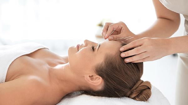 针灸美容针有效果吗