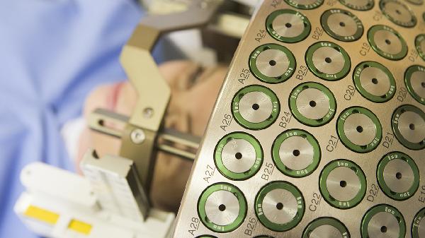 三叉神经伽马刀治疗