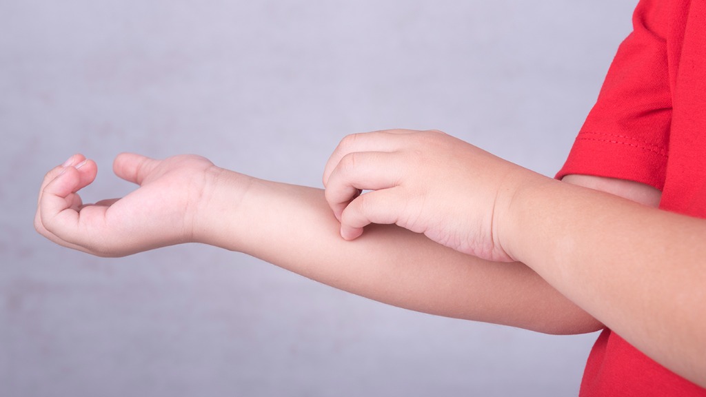 无论男女，皮肤出现这几个症状，多半是HPV缠身了，尽快检查医治