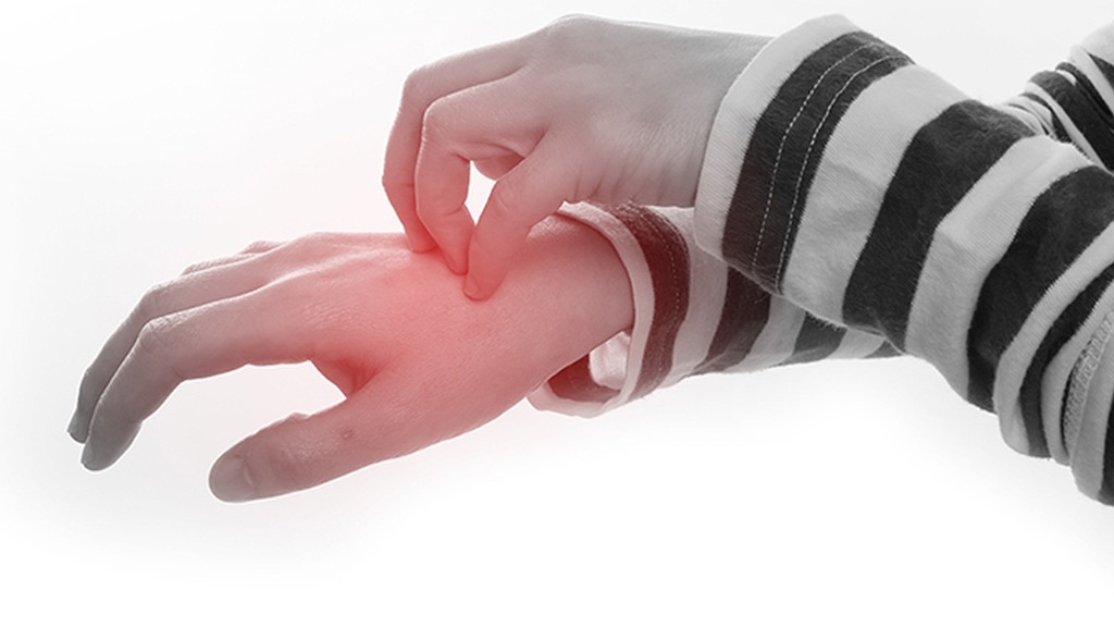 痒痒痒！你或是患上这几种季节限定的皮肤病，教你3招有效缓解瘙痒