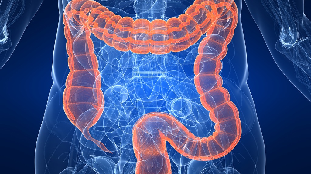直肠癌多是“拖”出来的，身体出现4种表现，肠道已“病”得不轻