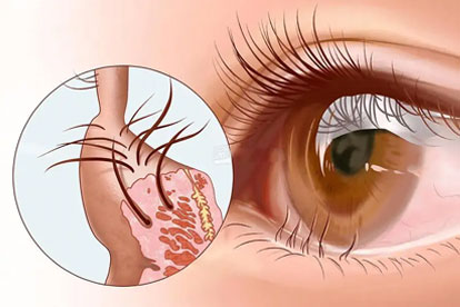 睫毛增长液有用吗