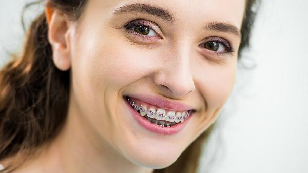 金属牙套中途能换隐形牙套吗