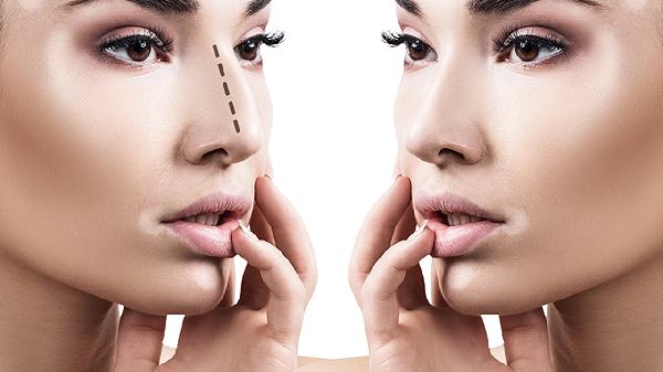 脸上凸出的肉痣可以去掉吗