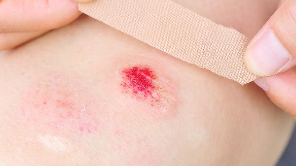 脸部皮肤凹陷怎么办