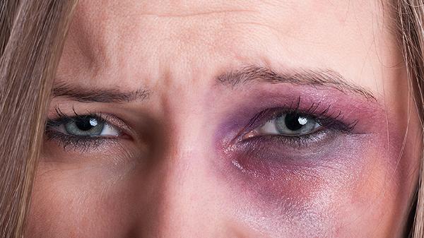 脸上有很多小坑怎么修复