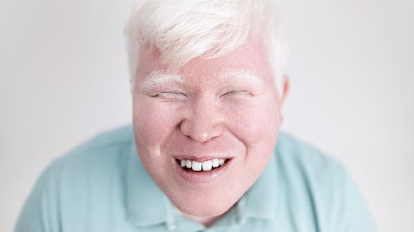 脸上长一点点的小凸起