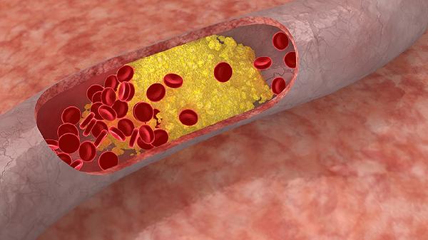 红细胞偏低是贫血吗？