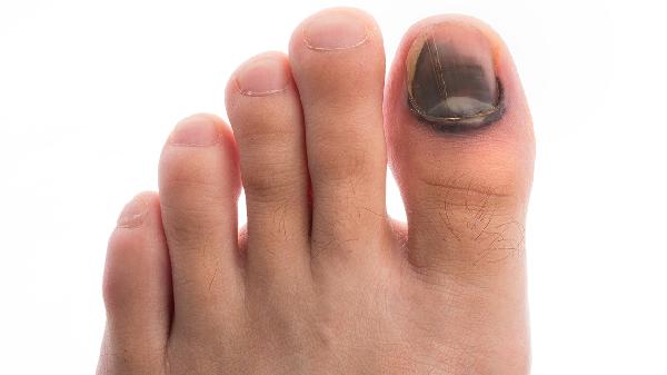 心血不足的症状表现有哪些