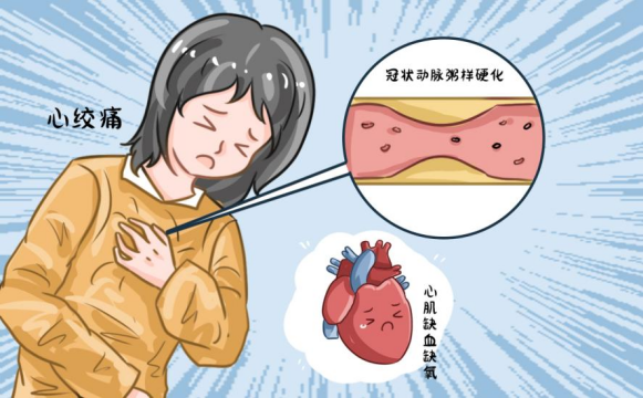 小雪至寒邪生，心绞痛突发怎么救？常备救心丸护心过寒冬