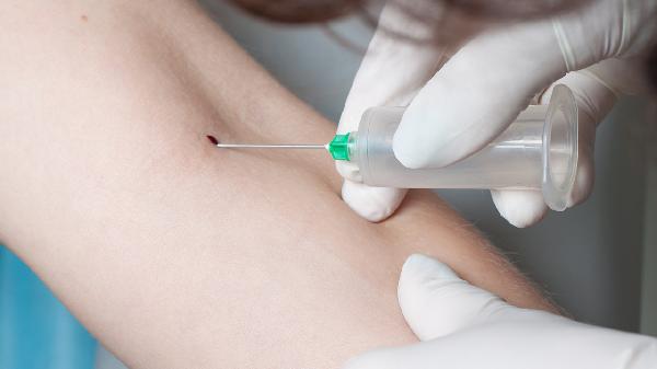 冬季养生首选！这种食物降血脂、促肌肉生长，比吃肉更健康