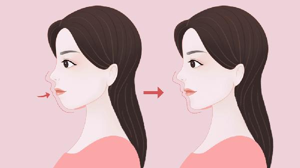 正颌手术有啥后遗症