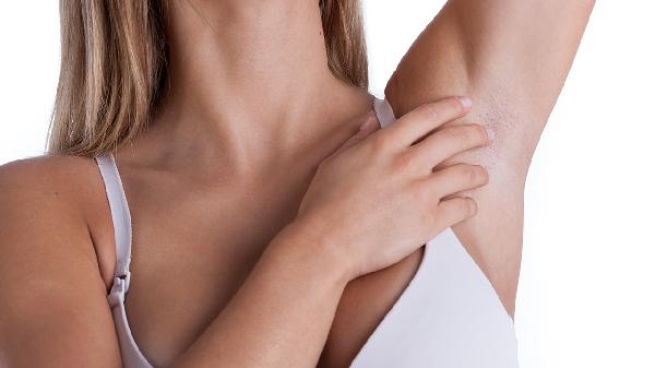 衣服腋下发黄是狐臭吗