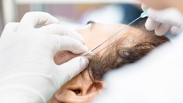 埋线一般保持多久