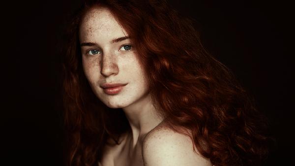 脉冲激光治疗雀斑效果怎么样