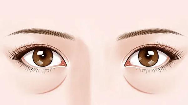 怎样可以有效的消除泪沟