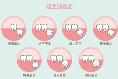 为何拔智齿后全身发冷