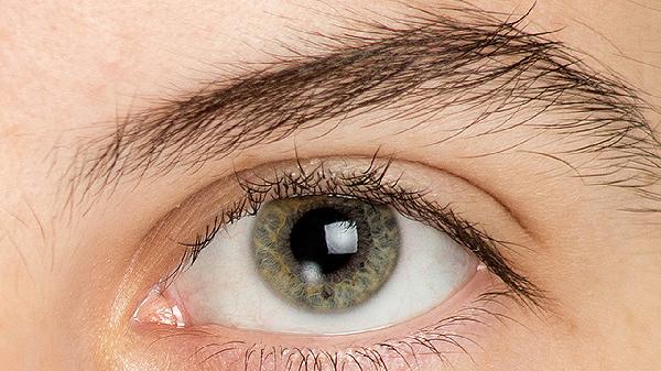 眼睛特别肿怎么办