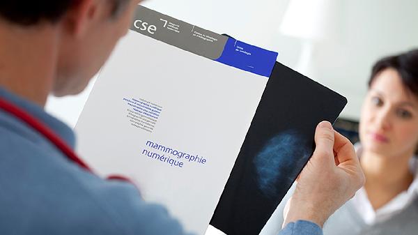 TCT报告ascus需要做HPV检查吗