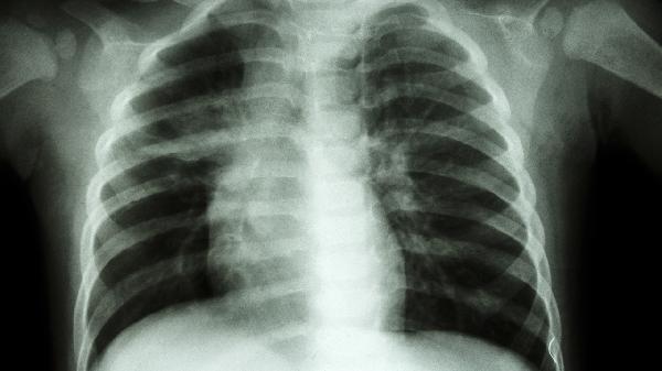 网球练完后吃水煮鸡胸肉补充蛋白质行吗