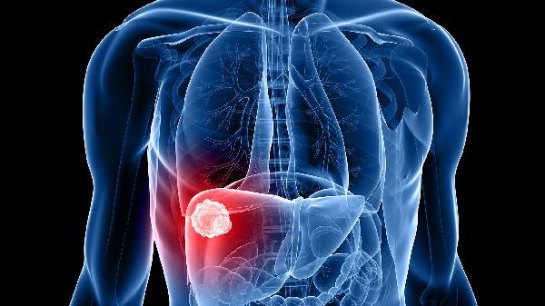 总胆红素高需要做肝功能复查吗