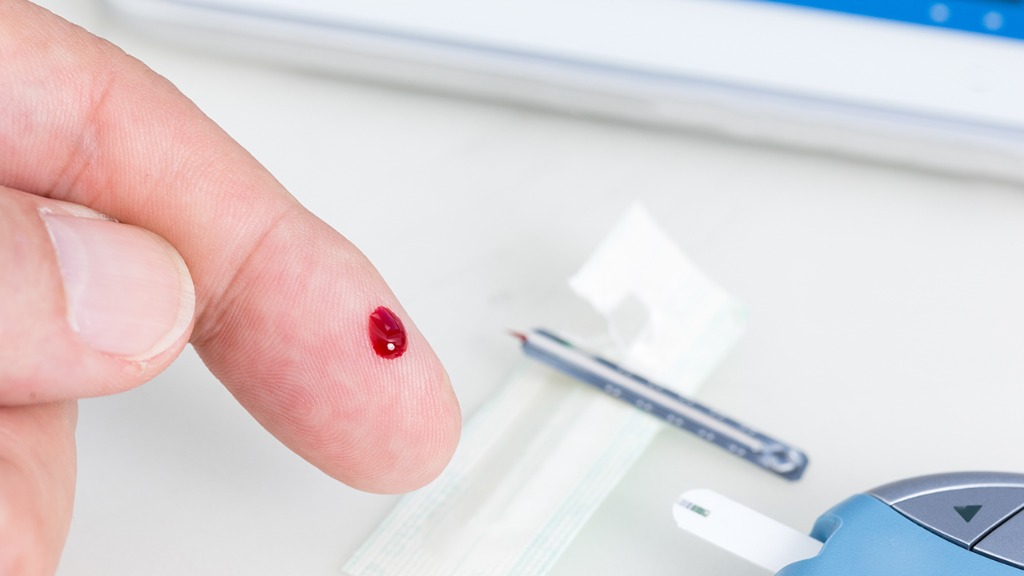 控糖不止管住嘴迈开腿！医生提醒：这4点才是关键